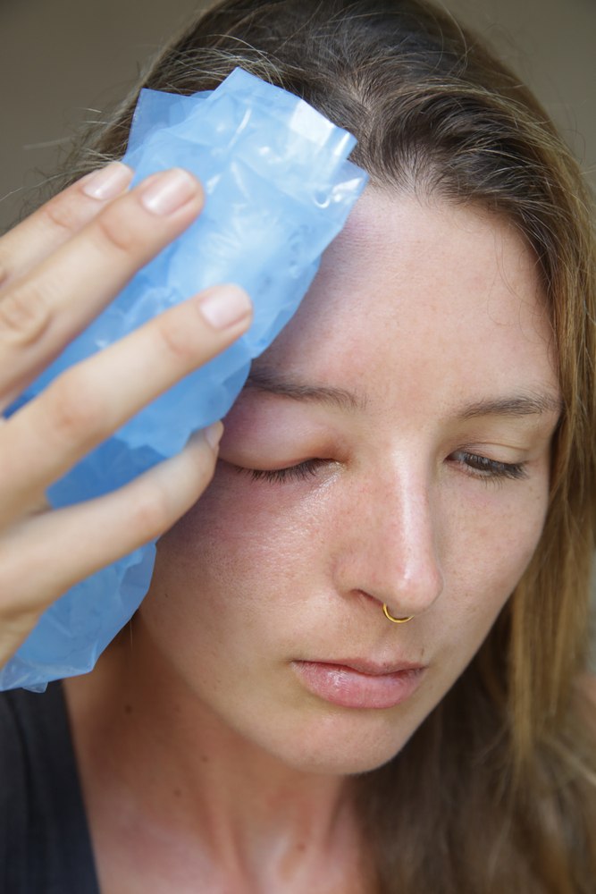 How Do You Treat An Insect Sting While Camping? How Do You Treat An Insect Sting While Camping?