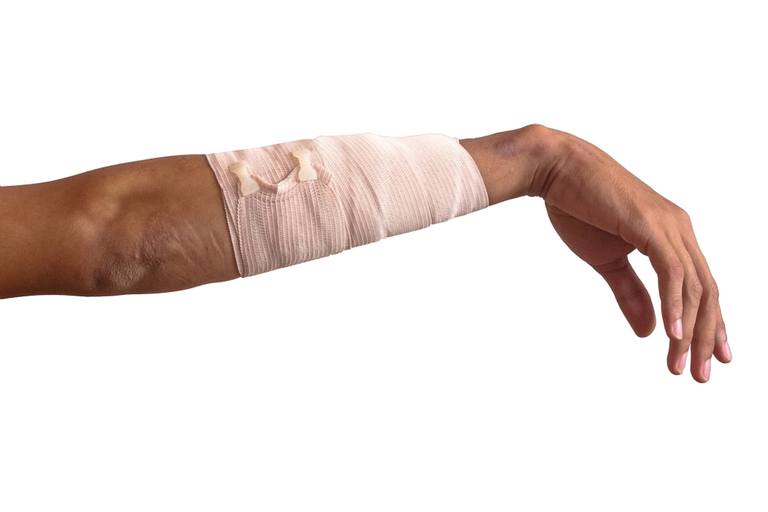 How to Treat Cuts, Scrapes, and Gouges in the Backcountry? How to Treat Cuts, Scrapes, and Gouges in the Backcountry?